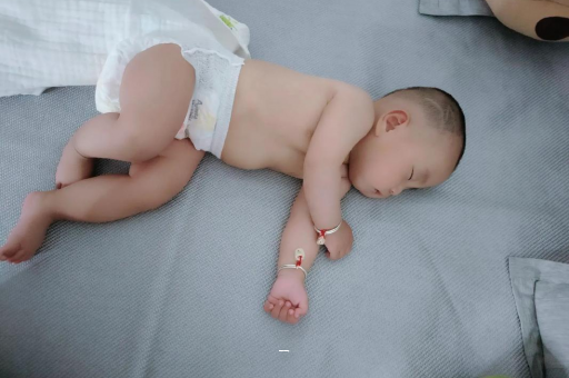 西安宝宝脸上有白色斑块 西安宝宝脸上有白色斑块